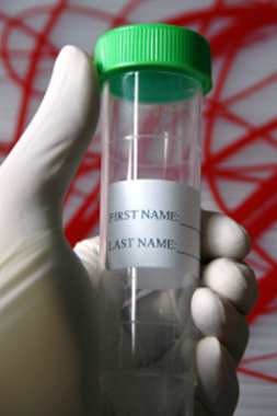 vial for blood test samples